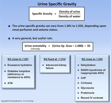 urine specific gravity chart